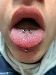 abgeheiltes venom bites piercing zungenpiercing tanjas piercing zungenpiercings