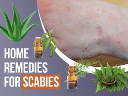See full list on mayoclinic.org 9 Home Remedies That Can Help Treat Scabies Boldsky Com