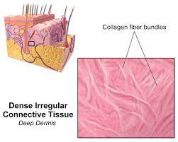 What Is The Difference Between Epithelial And Connective Tissue Epithelial Tissue Is Above The Basement Membrane Conn In 2021 Collagen Fibers Tissue Study Of Tissues
