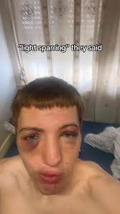 When You Perfectly Dodge The Combo in Sparring and Your Eyes Are Starting  to Look Like This