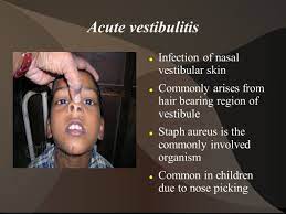 It often develops when hair follicles become infected, such as after a person picks their nose or plucks their nose hair. Conditions Involving External Nose Dr T Balasubramanian Ppt Download