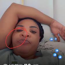 Dangers of using Mai Titi's Feliglow skin creams👇 nyaya yese iyo.