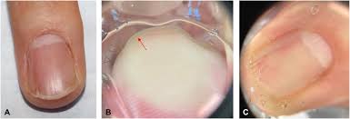 Image result for Faurea discolor