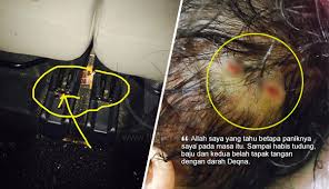 Darah Lencun Sampai Habis Tudung Baju Dan Tapak Tangan Dengan Darah Deqna Anak Terjatuh Dan Kepala Terkena Bucu Countries Around The World Around The Worlds