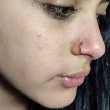 Crxnxs Body Piercing (@_crxnxs_) • Instagram photos and videos