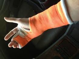Maybe you would like to learn more about one of these? Sprained Wrist Vs Broken Wrist Symptoms And Treatment