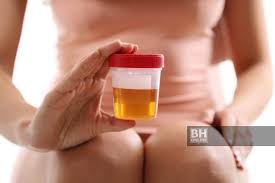 Infeksi ini dapat terjadi pada bagian manapun dari saluran kencing, termasuk kandung kemih, uretra, ureter atau saluran yang. Vhzbecujaszegm