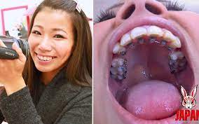 Japan Fetish Fusion tarafından Orthodontic Teeth Fetish: Izumi Asato's  Dental Fantasy | Faphouse
