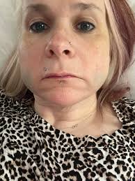 This was literally 25 minutes after getting them done my mouth was still  numb and my lips were swollen