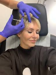 Make your fillers last longer. How To Make Your Botox And Fillers Last Longer Lunchpails And Lipstick Botox And Fillers Botox Facial Fillers
