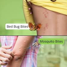 Image result for bedbugs bites