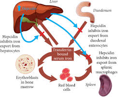 Maybe you would like to learn more about one of these? Limitations Of Serum Ferritin In Diagnosing Iron Deficiency In Inflammatory Conditions