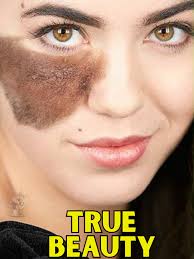 REAL BEAUTY #CassandraNaud #beauty #bodypositivity #EmbraceYourUniqueness  #pretty #SelfAcceptanceJourney #InspiringCassandra #DancerWithABirthmark  #CelebrateDifferences #LoveYourselfLikeCassandra ...