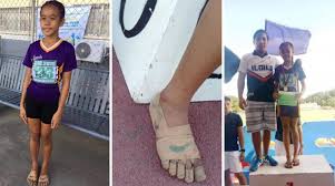 Jul 03, 2021 · campionii româniei 2020 (27). O FetiÈ›Äƒ SÄƒracÄƒ Din Filipine Face Atletism In Picioarele Goale Acoperite Doar De Bandaje Desenate Cu Carioca Antena 1