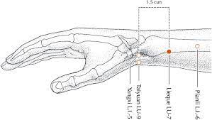 Immune Support And Tcm Affordable Acupuncture Ky