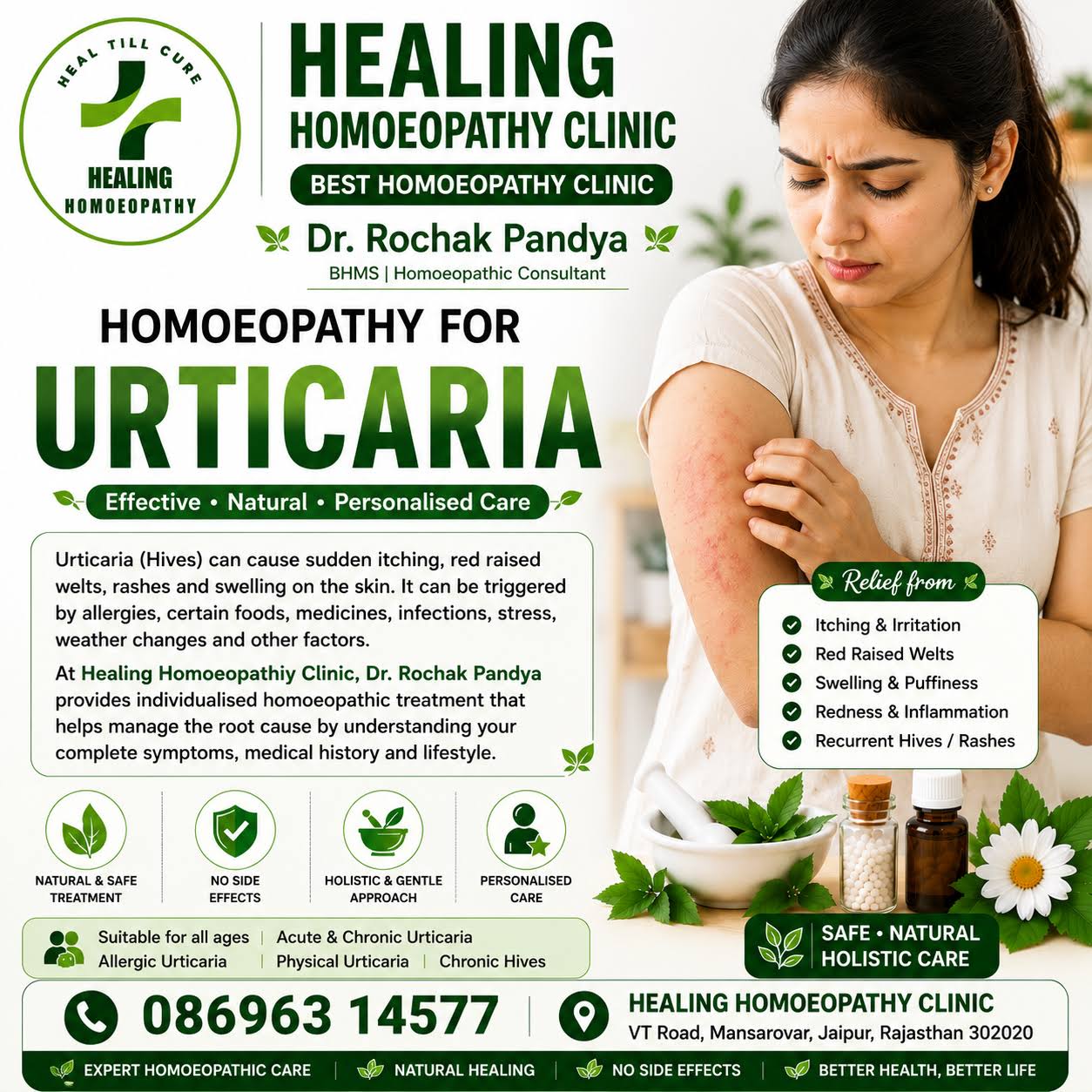 URTICARIA