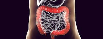 Image result for Virtual Colonoscopy