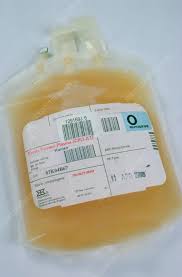 Image result for Plasma Transfusion