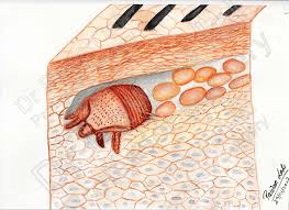 Image result for Sarcoptes scabiei life cycle