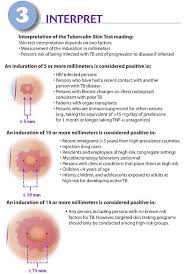 List of difference positive tb skin test vs. What Does It Mean If Your Tb Skin Test Is Negative Mccnsulting Web Fc2 Com