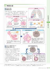 Check spelling or type a new query. ç—…4 3ç‰ˆ Webç«‹ã¡èª­ã¿ 181106