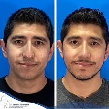 Buenos resultados !!! #hospitalangeles