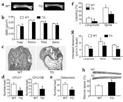 Long bone online worksheet for high school. Jci Impaired Osteoblastic Differentiation Reduced Bone Formation And Severe Osteoporosis In Noggin Overexpressing Mice