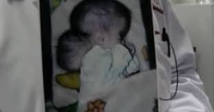 Image result for deformed babies in Iraq caused by depleted uranium