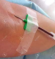Bei der eigentlichen blutspende wird blut abgenommen und in seiner natürlichen anschließend wird die nadel wieder entfernt und ein druckverband wird angelegt, der. Nadel In Das Blutspender Arm Wahrend Der Blutspende In Das Krankenhaus Lizenzfreie Fotos Bilder Und Stock Fotografie Image 39485455