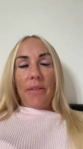 Good morning my MS brethren, my name is Gerren Thomas and I was diagnosed  back in 2011. I'm