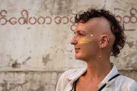 Hairstyles For Alopecia They Do Exist Lady Alopecia