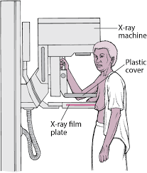 This test is most often used to look at the chest and/or belly (abdomen) to see if breast cancer has spread to other organs. Quick Facts Breast Cancer Msd Manual Consumer Version