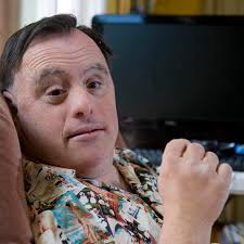 Chromosome 21?: UCI researchers studying link between Down syndrome and  Alzheimer's