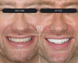 Joseph Stan, DDS (@drjosephstan) • Instagram photos and videos