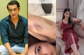 Nora yang diketahui merupakan model sekaligus selebgram kini ramai diperbincangkan. Bongkar Tabiat Aliff Alli Khan Nora Alenxandra Beri Dukungan Pada Aska Ongi Sama Sama Alami Kdrt Semua Halaman Hype