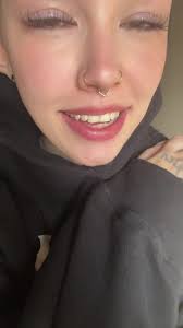 Bald Girl Takes Off Her Eye Brows