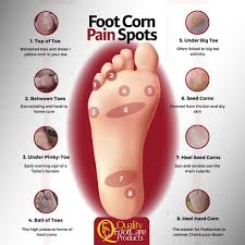Image result for Corns