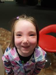 Natalia Jayde's journey with lymphedema