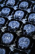 Image result for CT Head