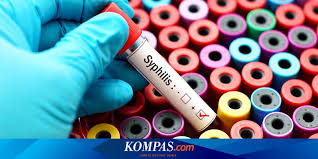 Untuk konsultasi dan pemesanan obat sipilis dan obat kencing nanah serta berbagai obat herbal lainya dari de nature indonesia hubungi kami di tlp/sms/whatsapp: Penyakit Menular Seksual Sifilis Kenali Tahapan Dan Gejala Infeksinya Halaman All Kompas Com