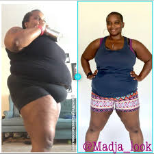 Pin On Before And After Weight Loss Stories