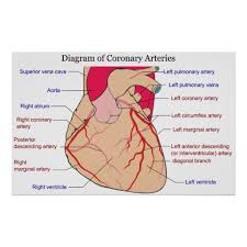 Number of diagonal arteries / wiki: Diagram Of The Coronary Arteries Of A Human Heart Poster Zazzle Com Coronary Arteries Heart Catheterization Coronary