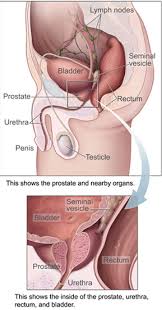 Ostryj Prostatit Vikipediya