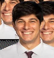 Nail-plate Combination Treatment of Ipsilateral Humeral Shaft and Distal  Humerus Fractures