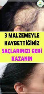 Mutfagimizin Vazgecilmezleri Olan Yumurta Ve Bal Bakin Baska Nelere Yariyor Insanlar Sac Dokulmesini Ve Kelligi He Haarausfall Schonheitsideal Schonheitstipps