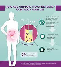 We did not find results for: Azo Urinary Tract Defense Keeps Your Uti From Progressing