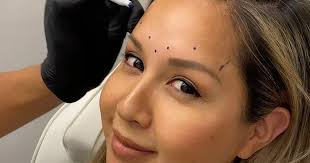 My Youth Med Spa Offers Botox For Men in West Hollywood, CA 90046