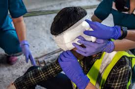 The Remarkable Role of the Brain’s Waste Disposal System in Preventing Swelling After an Injury