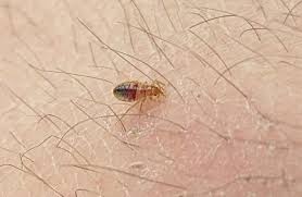 Image result for Cimex lectularius bites