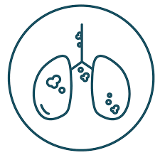 Some people will not receive a diagnosis until they already have stage 4 lung cancer because they have had little or no symptoms. Stage Iv Lung Cancer Details Prognosis Treatment